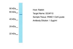 DCAF10 Rabbit anti-Human, Polyclonal, Novus Biologicals 0.1 mL | Buy Online | Novus Biologicals | Fisher Scientific
